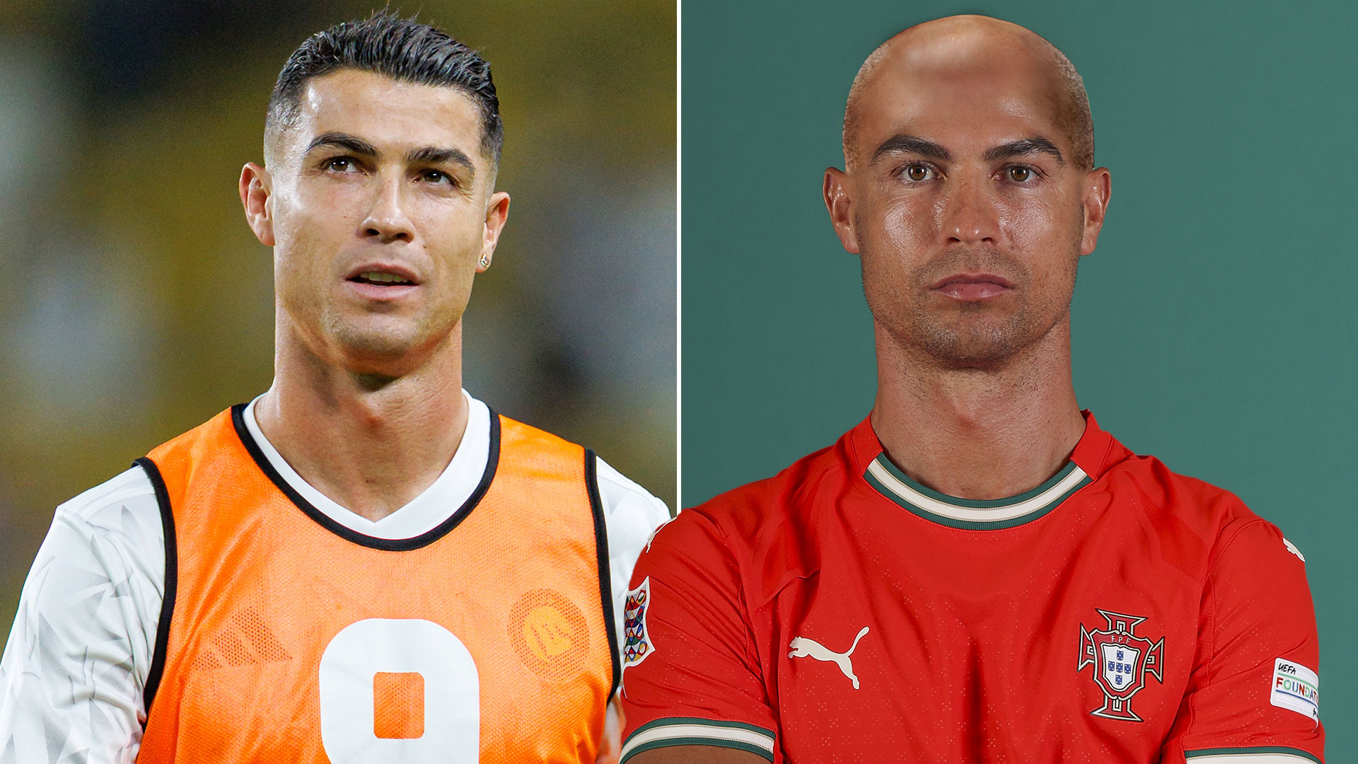 "بدون الشعر، لن أكون كما كنت" - يكشف كريستيانو رونالدو كيف أن علاج الشعر يعزز احترامه لذاته
 ستاديوم بوست