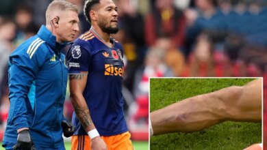 ضربة نيوكاسل حيث أجبر جويلينتون على الخروج بإصابة سيئة
 ستاديوم بوست