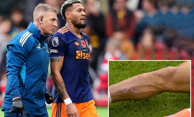 ضربة نيوكاسل حيث أجبر جويلينتون على الخروج بإصابة سيئة
ستاديوم بوست