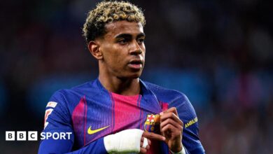 إسبانيا: خروج لامين يامال من الفريق بعد إجراء عملية في الفخذ
 ستاديوم بوست